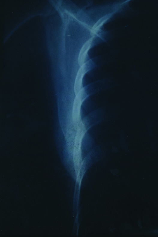 Snowbed - Georgia Ponirakou - Phases Magazine