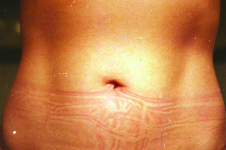 Snowbed - Georgia Ponirakou - Phases Magazine